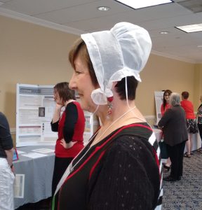 CE 419 modeled, shows how small this cap is. 